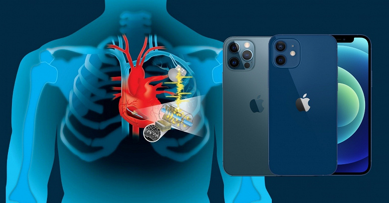iPhone 12 и кардиостимулятор пока не враги. FDA утверждает, что риски невелики, но советует перестраховаться